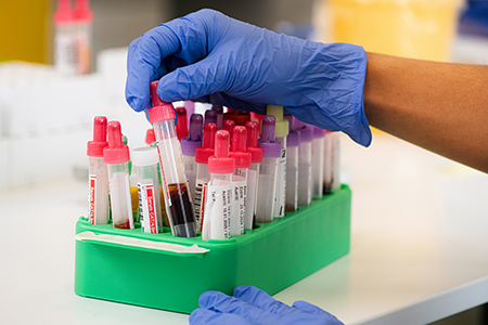 Biomed. Analytikerin Blutproben Detail