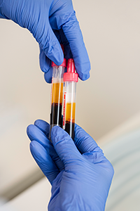 Biomed. Analytikerin Blutröhrchen